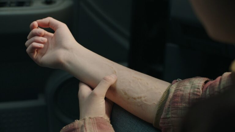 Ellie examines the scar from her bite on her forearm, a haunting reminder of her immunity in The Last of Us.